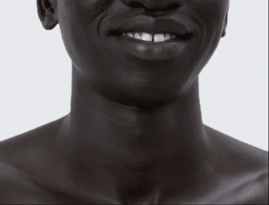 White Teeth